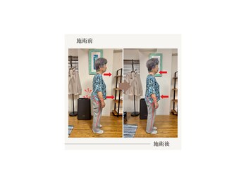 バレルメディカル研究所 恵比寿/身の回りのことが出来るように!