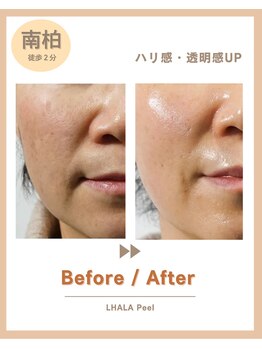 ニコリバランス(nico.Rebalance)/ハリ、透明感で若々しいお肌へ