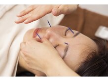 マッサージ鍼灸院つゆき按腹堂/眼精疲労にも効果抜群！