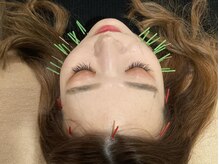 アキュティ 吉祥寺(Acuty)