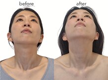 レジスタ(REGISTA)/【首のこり】