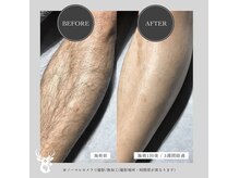 グランズ 芦屋(GLANZ)の雰囲気（圧倒的な効果と価格【芦屋/西宮/脱毛/メンズ脱毛/学割】）