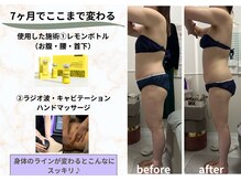 ラン(Ran)/レモンボトルボディ♪