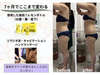 ラン(Ran)/レモンボトルボディ♪