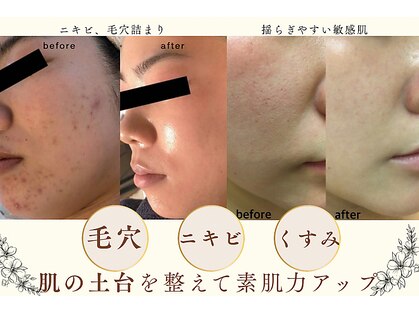 プログレス(PROGRESS)の写真