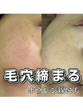 アイラッシュネイルサロン ブリエ(Briller)/スキンケアフェイシャルWAX