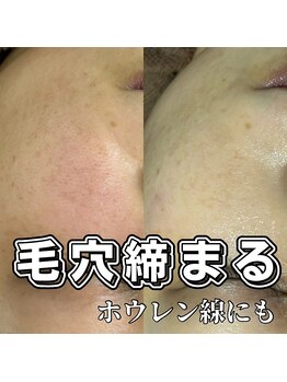 アイラッシュネイルサロン ブリエ(Briller)/スキンケアフェイシャルWAX