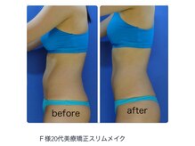 エステージ(estage)/