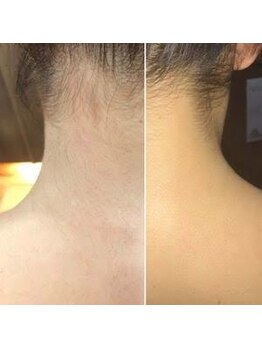 ココ 茅ヶ崎店(Coco)/ブライダルシェービング