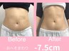 ★おすすめ★【痩身/肩こり/代謝UP】腸もみ40分＋背中20分　19000円→8500円