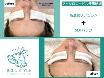 ベルスタイル(Bell style)/当店のお客様症例