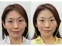 宮崎整体院/【小顔矯正・顔の歪み矯正】