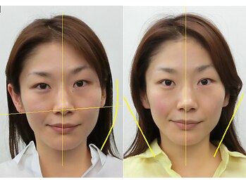 宮崎整体院/【小顔矯正・顔の歪み矯正】