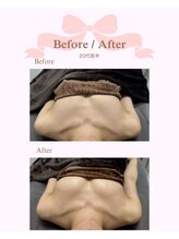 ロココ 安城店(Rococo)/バストアップ症例