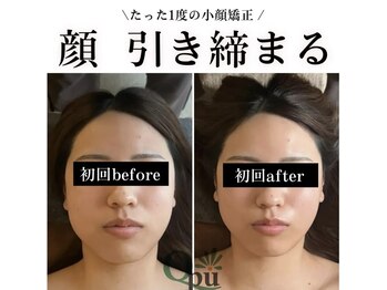 キュープ 鹿児島伊集院店(Qpu)/