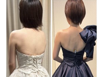 バイオレットの写真/【ブライダルエステや痩身だけでなく骨格から別人級痩せ魅せシルエットに♪】