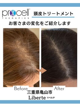 リベルテ(Liberte)/プロセル頭皮トリートメント
