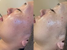 トトノエ(TOTONOE)/クリスティーナ-アンストレス-