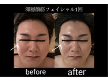 マシュマロヘッド 目黒店(Mashumaro Head)/本格顔深層筋小顔フェイシャル 