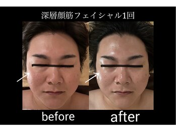 マシュマロヘッド 目黒店(Mashumaro Head)/本格顔深層筋小顔フェイシャル 