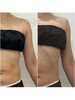 プライベートサロン ルクサージュ(Luxeage)/温活DETOX