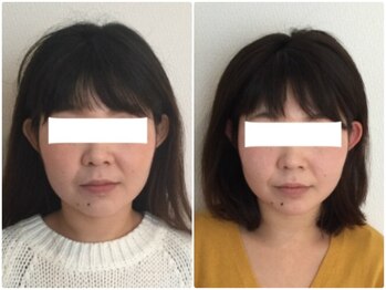 美容整体 ウェリナ 蟹江院/小顔矯正/骨盤矯正/美脚サロン