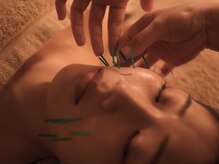 寝譜(nefu)の雰囲気（お悩みに合わせたオーダーメイドの美容鍼施術）