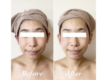 サロンミッシェル(Salon Michel)/