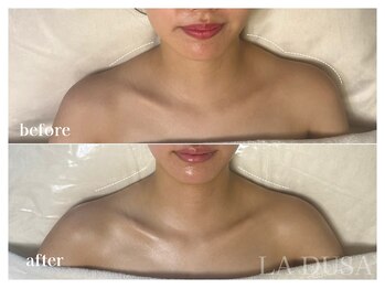 ラ ドゥーサ(La Dusa)/ガチガチ肩こりも改善