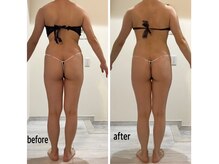スキニー 六本木店(Skinnie)/32歳女性120分コース2回目