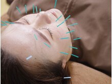 やの鍼灸治療院/繰り返す肌トラブルの改善に◎