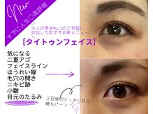 ハティハティ(HATI- HATI)の雰囲気（【悩みに特化した】高周波RFでコスパ&タイパ抜群◎高評価★★★）