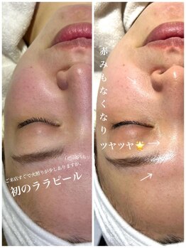 ラッシュワン 四条店(Lash One)/ララピール