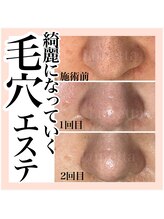 ルネッタ(Lunetta)/