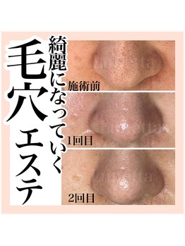 ルネッタ(Lunetta)/