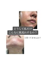 シャムリー 並木坂(Syamry)/無料カウンセリング　豊富な知識