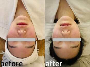 メナードフェイシャルサロン 西五反田/毛穴/トーンUP/引き上げ