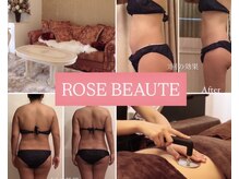 ローズボーテ(ROSE BEAUTE)