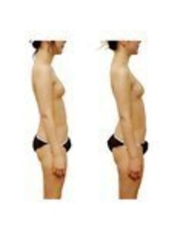 ベンザイ 新潟店(BENZAI)/肩/首/反り腰/腰痛/全部解決◎