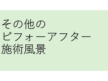 リアナ(LIANA)/施術風景、ビフォーアフター