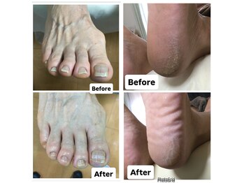 リゼラアンドコー 宇都宮店