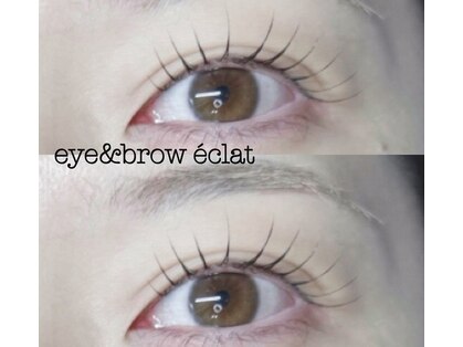 エクラ(eclat)の写真