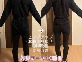 ヨサパーク ラウレアボディ 昭島店(YOSA PARK Laule'a Body)/お客様before/after