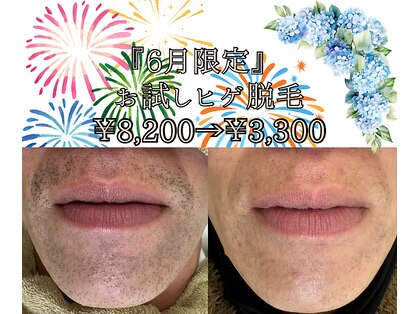 ビビの写真