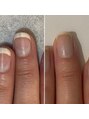 ランカ(RUNKA) 【最強のネイルケア】3ヶ月で自爪育成