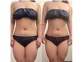 サロン ド ベル(salon.de.Belle)/インドマッサージbefore→after