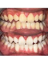 ライトビューティー 池袋店(LightBeauty)/症例写真