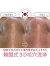 【学割U24】韓国式◎毛穴の黒ずみごっそり★毛穴撲滅！韓国式3D毛穴洗浄
