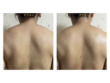 ラレコルト/ビフォーアフター