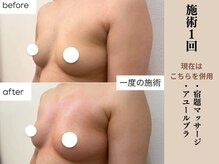 ソワ(soie)/サイズアップ＆ツンと上向き